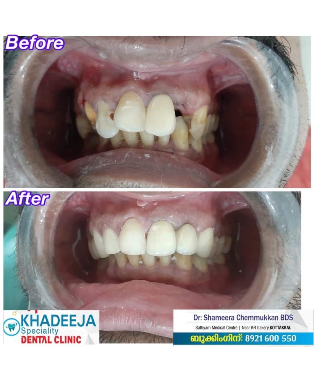 Khadeeja Speciality Dental Clinic